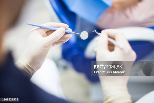 dentist at work with tools - rimotore di placca foto e immagini stock