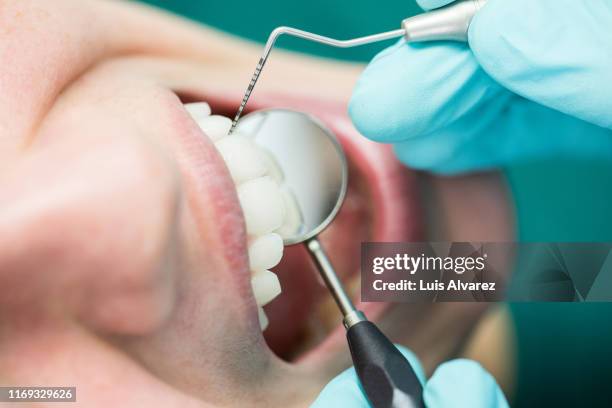 dentist examining patient teeth with dental tools - dentista foto e immagini stock