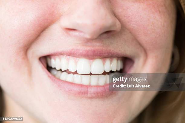 woman with beautiful toothy smile - sbiancamento dentale foto e immagini stock