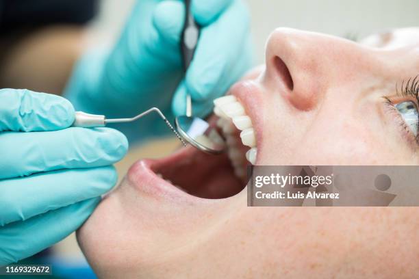 woman getting a dental check-up at dentistry - dientes humanos fotografías e imágenes de stock