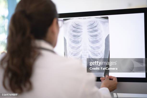 Ics Radiogram 94 Radiogram Stock Photos, High-Res Pictures, and Images - Getty Images