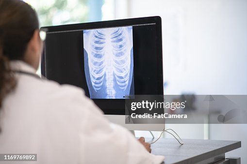 Reviewing a chest x-ray on the computer Reviewing a chest x-ray on the computer