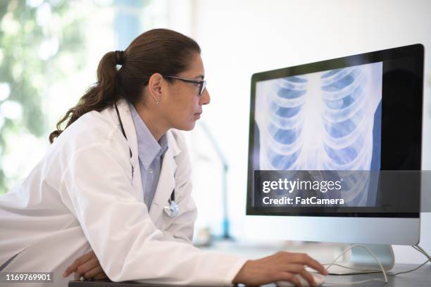 mujer doctora especula sobre la imagen de rayos x - medical x ray fotografías e imágenes de stock