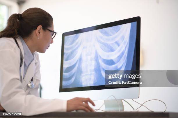 radiologist examines a chest x-ray on her computer - person screened for cancer stock pictures, royalty-free photos & images