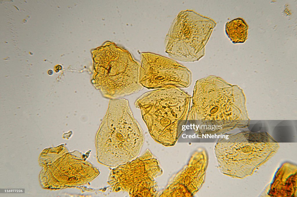 Cheek cells micrograph