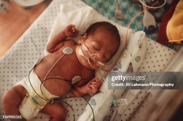 premature baby sleeps in nicu in his isolette with oxygen and feeding tubes - oxygen tube stock pictures, royalty-free photos & images