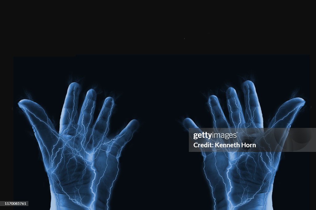 Electrified hands held open in disbelief