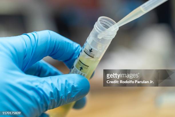 medical microbiologist holding a urine tube for chlamydia testing - ets fotografías e imágenes de stock