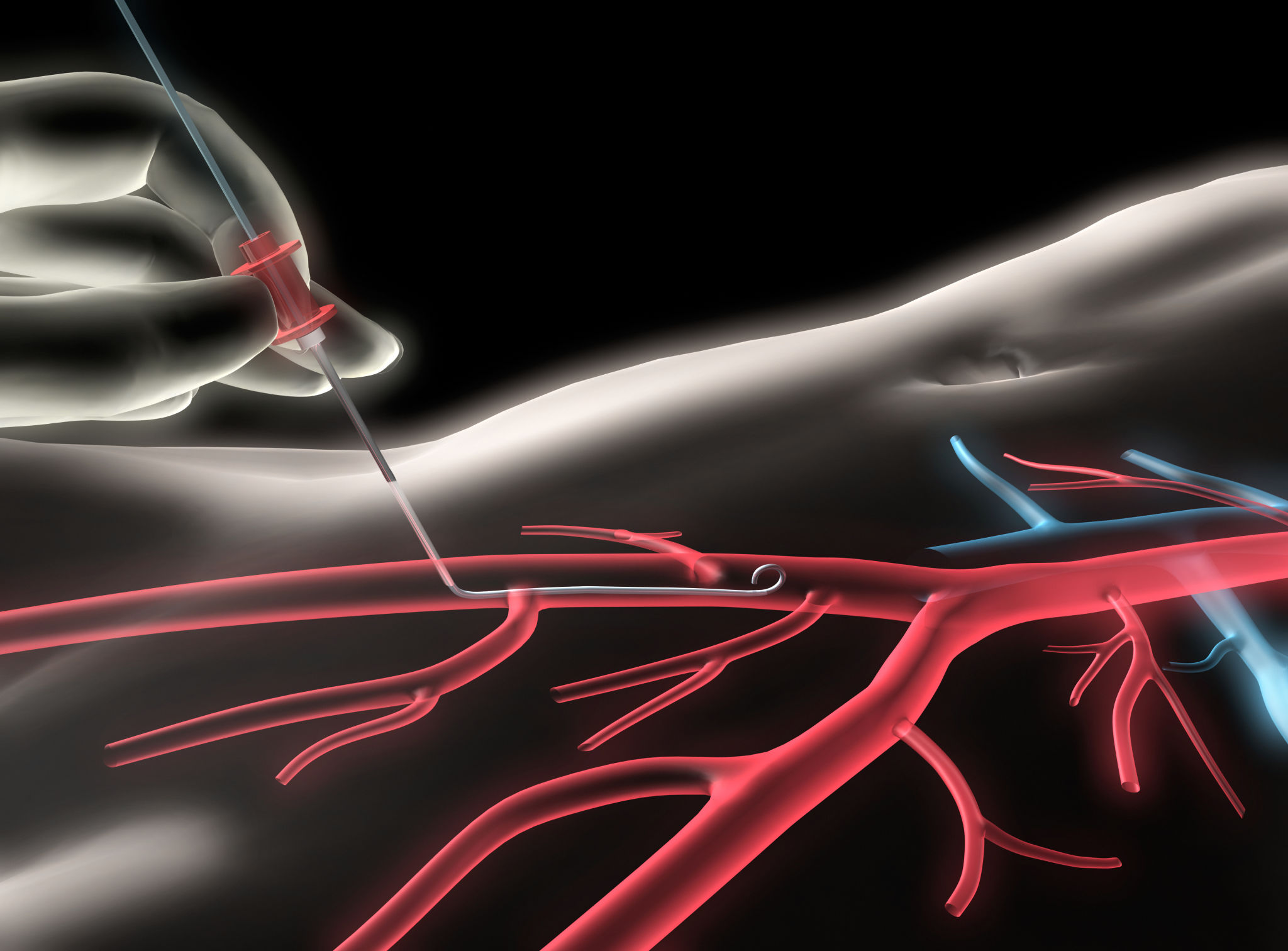 cirurgia vascular