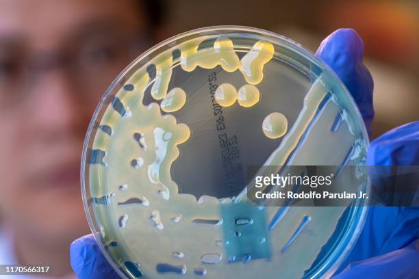 microbiologist showing the mucoid colonies of a multi-drug resistant coliform bacteria (klebsiella pneumoniae) on culture plate. carbapenemase-producing enterobactericeae - klebsiella pneumoniae stock pictures, royalty-free photos & images