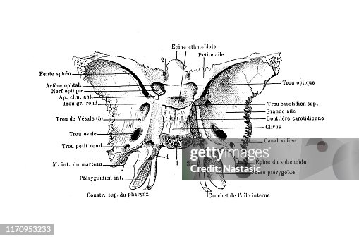 Sphenoid bone Sphenoid bone