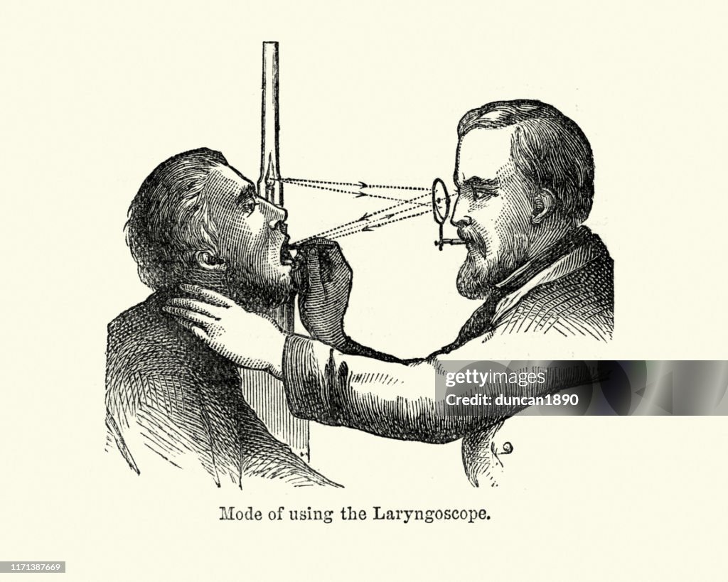 Médico victoriano que usa un laringoscopio para examinar una laringe de pacientes