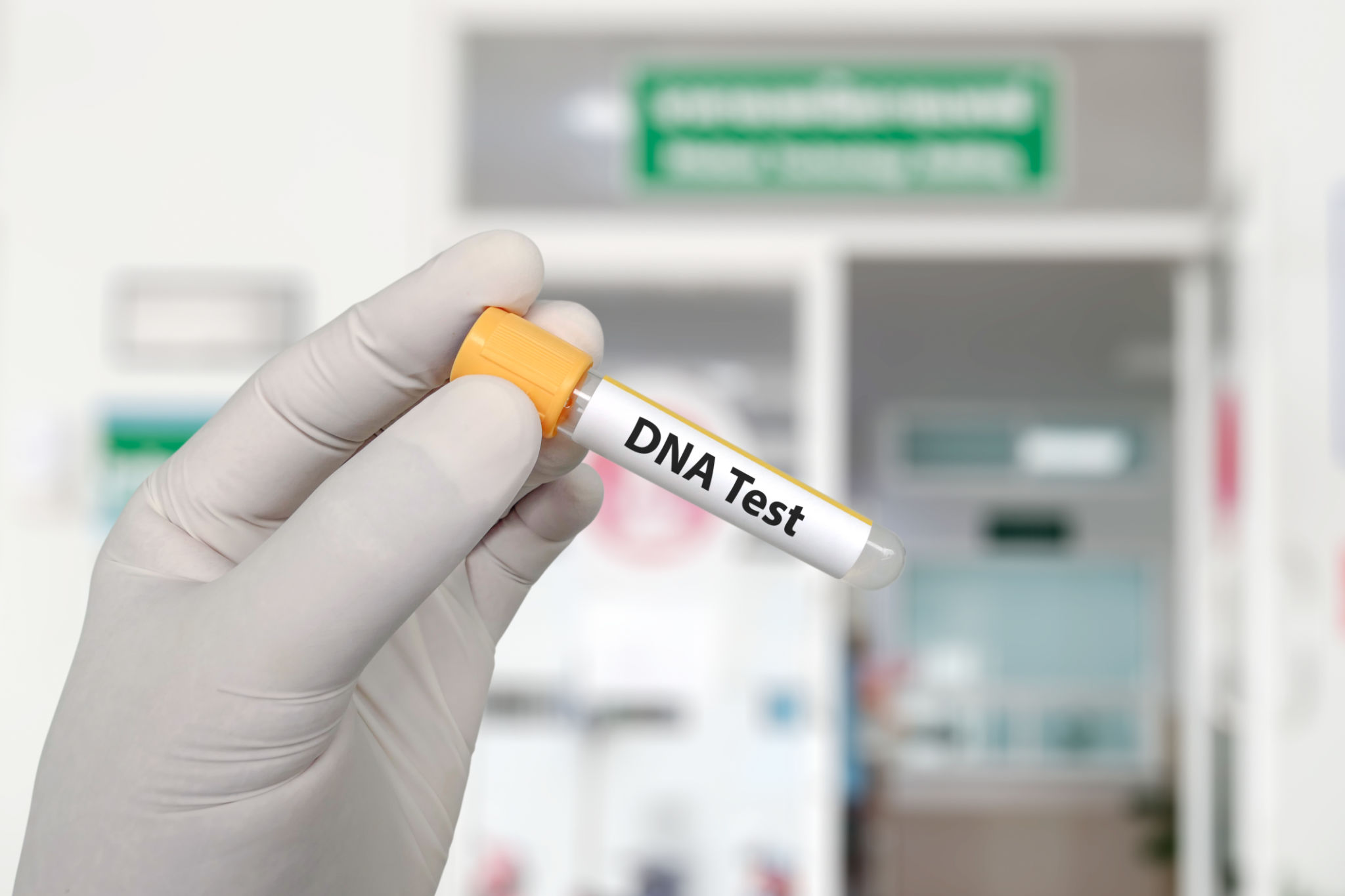 family dna test