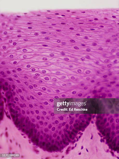 esophagus, human--stratified squamous epithelium, 100x - plaveiselcelepitheel stockfoto's en -beelden