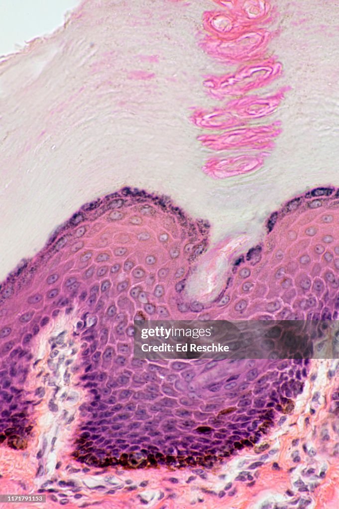 SKIN, EPIDERMIS--LAYERS and MELANOCYTES in the BASAL LAYER, Keratinized thick skin, 100X