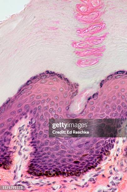 skin, epidermis--layers and melanocytes in the basal layer, keratinized thick skin, 100x - stratum corneum 個照片及圖片檔