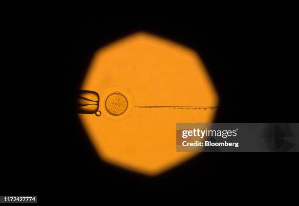 Picture taken from an electron microscope displays Oocyte manipulation at a laboratory of the Kulakov national medical center for obstetrics,...