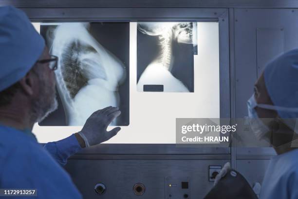 cirujano discutiendo sobre radiografía de tórax con colega - panel de luz fotografías e imágenes de stock