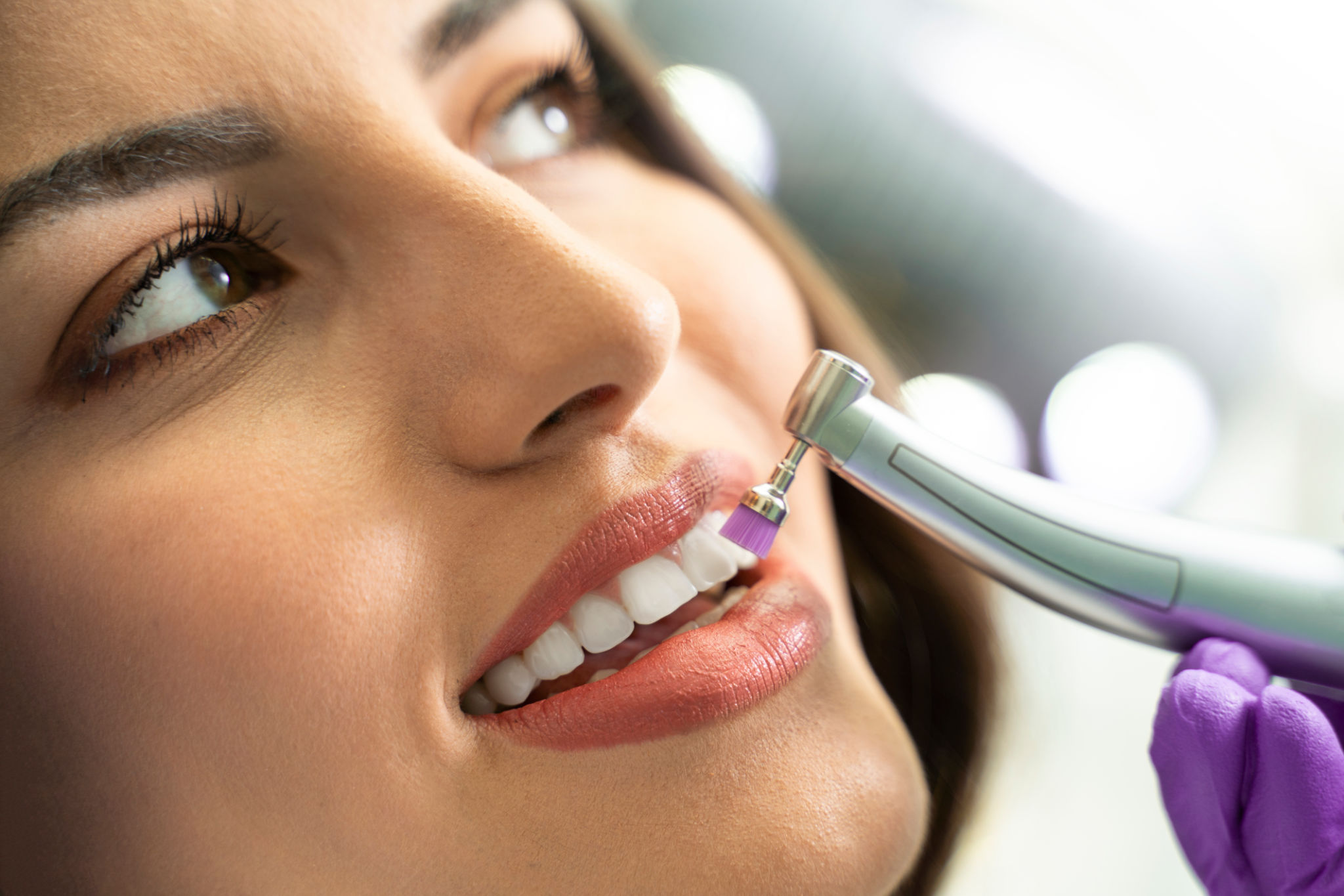 teeth polishing
