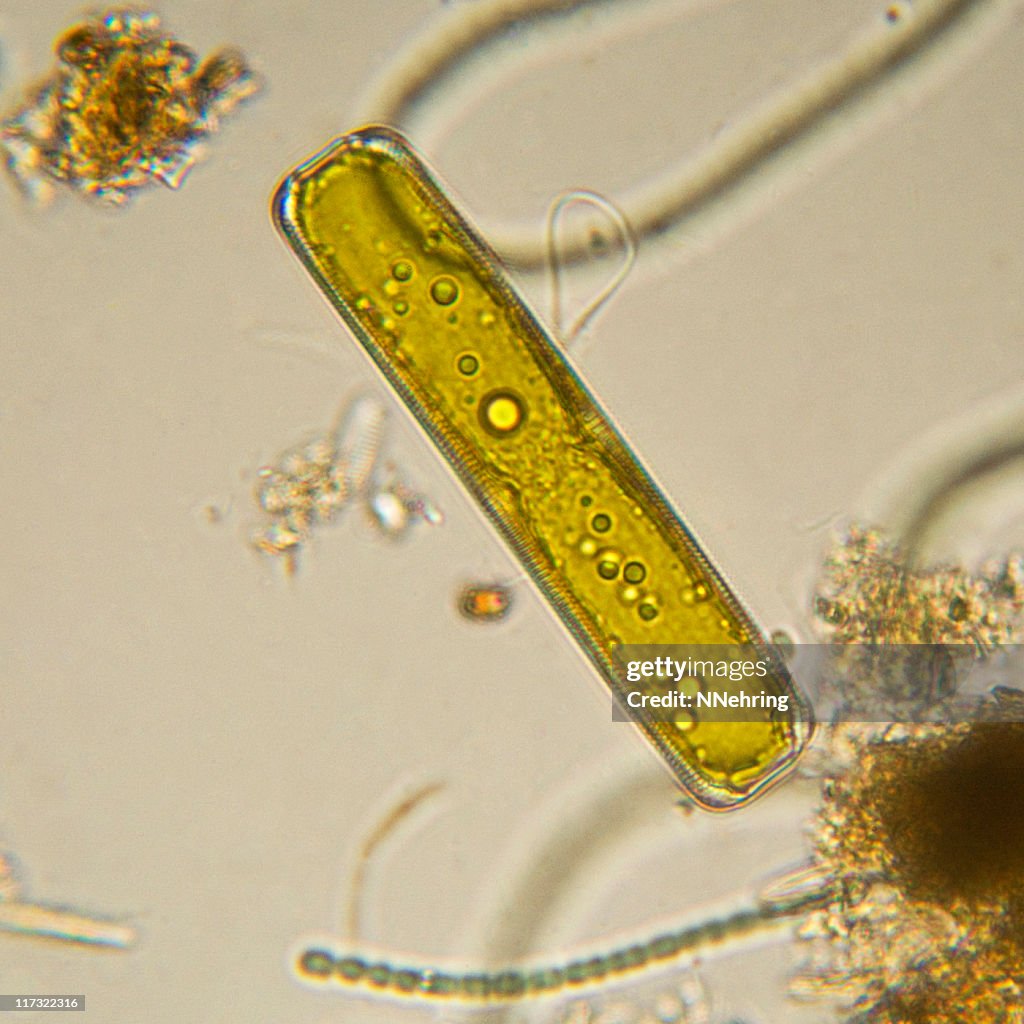 Diatom, Pinnularia species, micrograph
