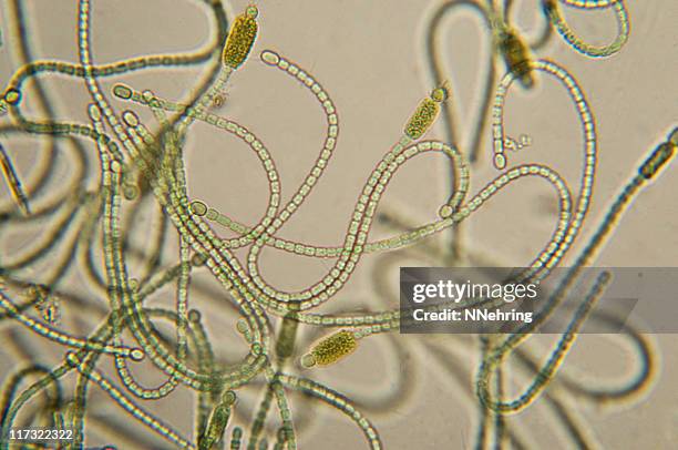 cyanobacteria microscopie - algue bleue photos et images de collection