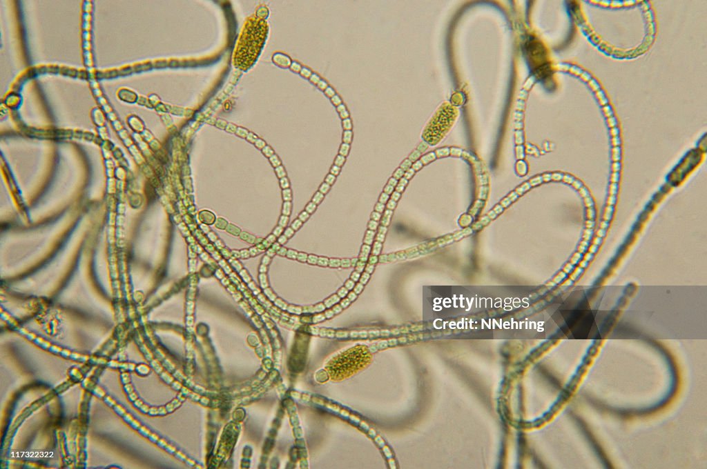 Cyanobacteria micrograph