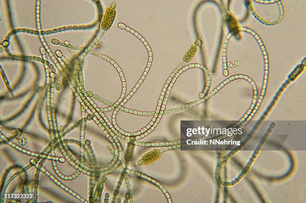 Cyanobacteria Micrograph High-Res Stock Photo
