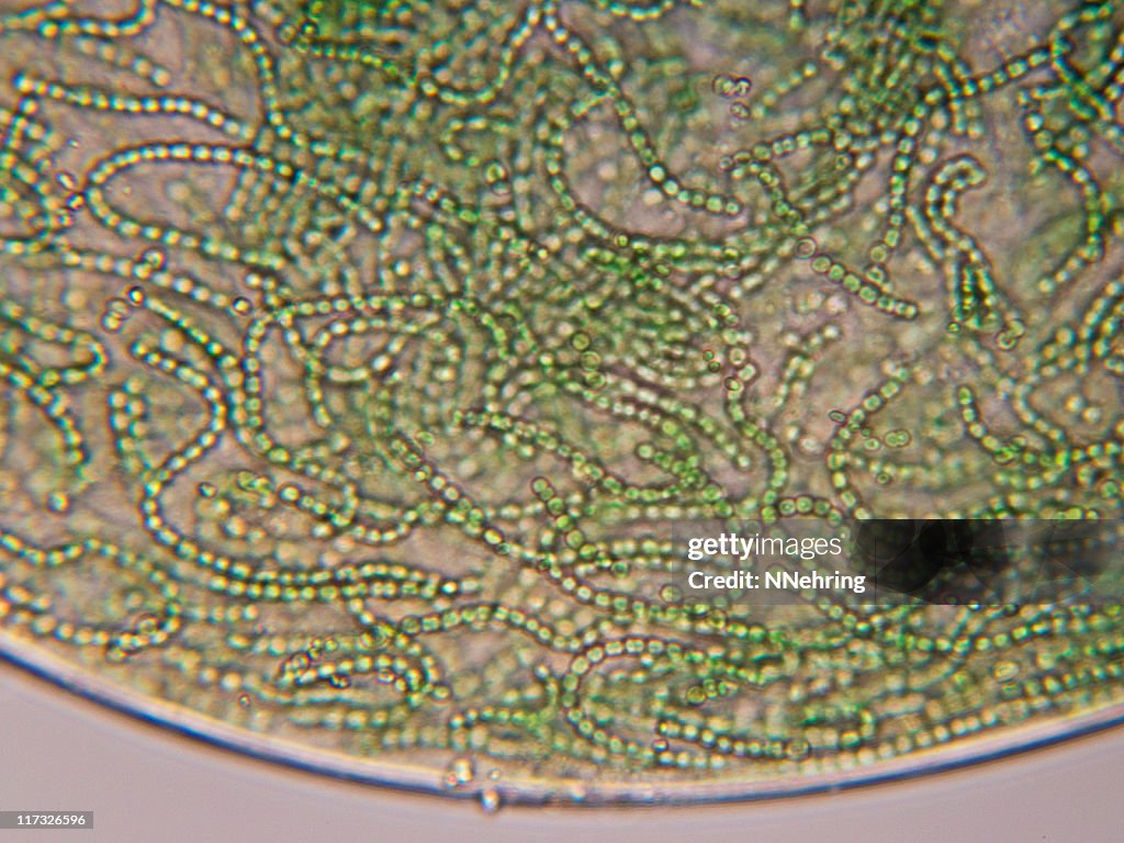 Nostoc cyanobacteria micrograph