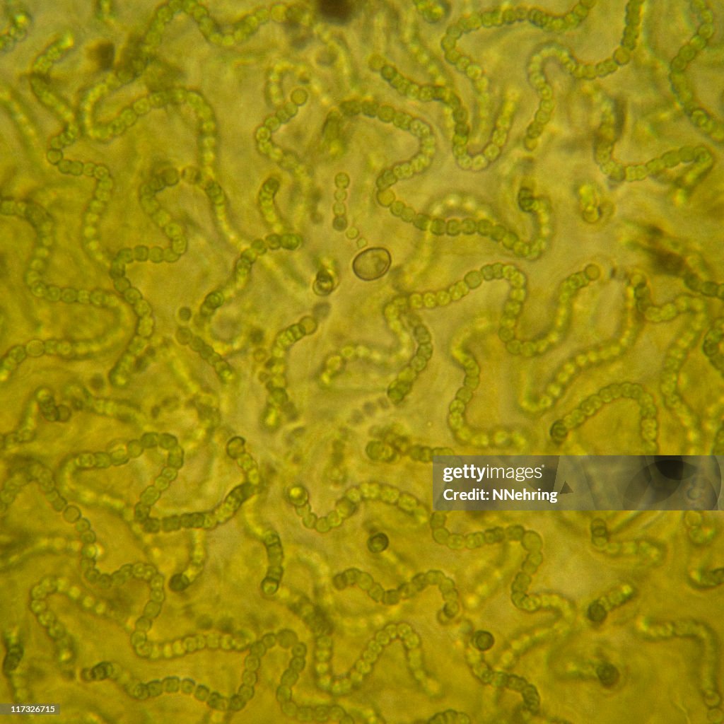 A colony of Nostoc cyanobacteria