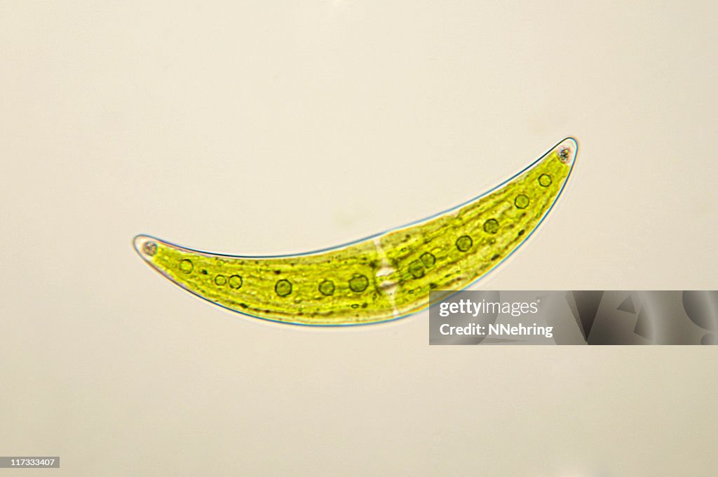Closterium espécies Desmídia Micrografia