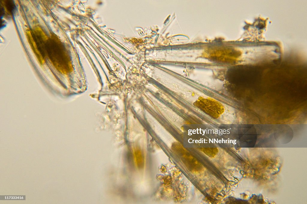 コロニー diatoms の顕微鏡写真