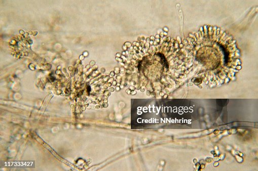 Aspergillus bread mold micrograph Aspergillus bread mold micrograph