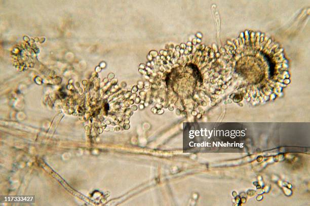 micrografia aspergillus bolor do pão - fungos imagens e fotografias de stock