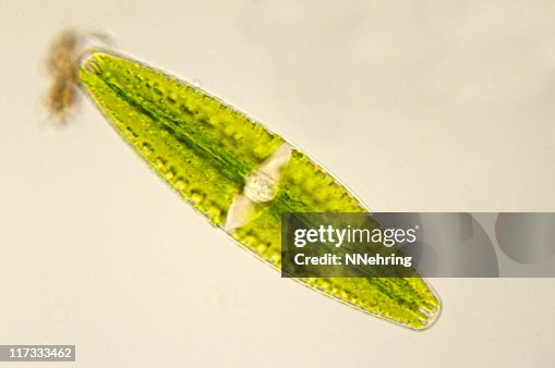 Netrium desmid micrograph Netrium desmid micrograph