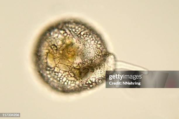 shelled amoeba micrograph - ameba stock pictures, royalty-free photos & images