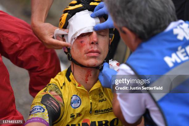 Image depicts graphic content] / Tony Martin of Germany and Team Jumbo-Visma / Injury / Crash / Pull out of the race / Abandon / Doctor / Medical /...