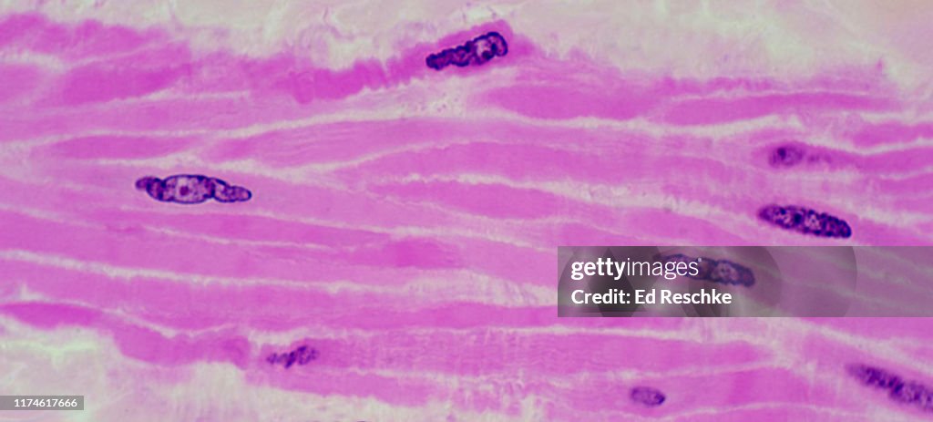 Smooth Muscle In The Urinary Bladder 250x High-Res Stock Photo - Getty  Images