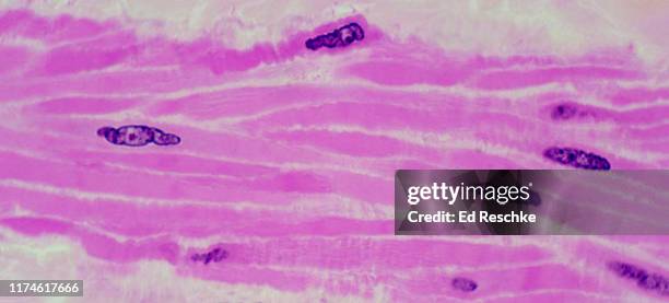 smooth muscle in the urinary bladder 250x - smooth muscle stock pictures, royalty-free photos & images