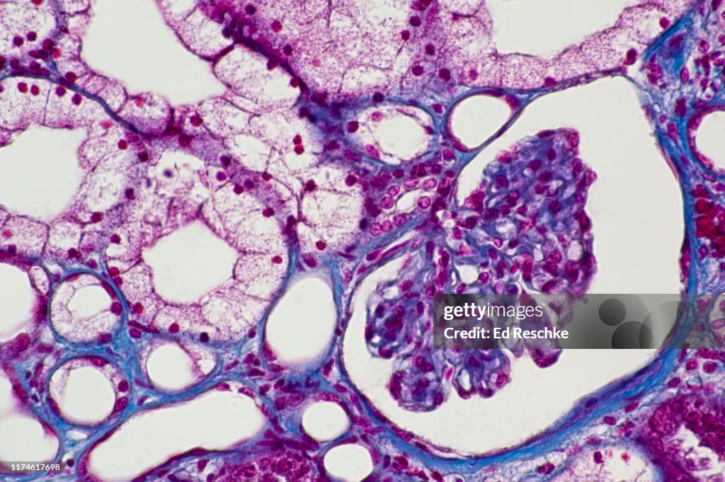 NEPHRON, RENAL CORPUSCLE and RENAL TUBULES--GLOMERULUS, BOWMAN'S CAPSULE, MACULA DENSA, DISTAL, CONVOLUTED TUBULES, PROXIMAL CONVOLUTED TUBULES, 100X