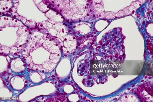 nephron, renal corpuscle and renal tubules--glomerulus, bowman's capsule, macula densa, distal, convoluted tubules, proximal convoluted tubules, 100x - capillary body part stock pictures, royalty-free photos & images
