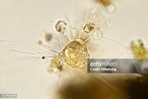acineta species micrograph - ciliate stock pictures, royalty-free photos & images