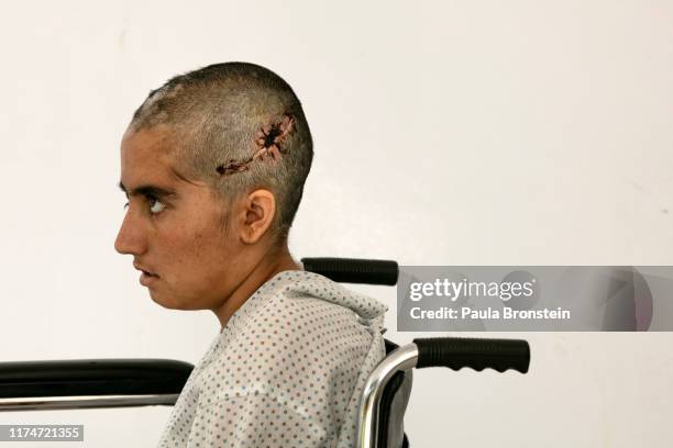 Nasifa from Ghazni Province, who received a traumatic brain injury caused by a bomb blast outside her home, is seen in her wheelchair at the...