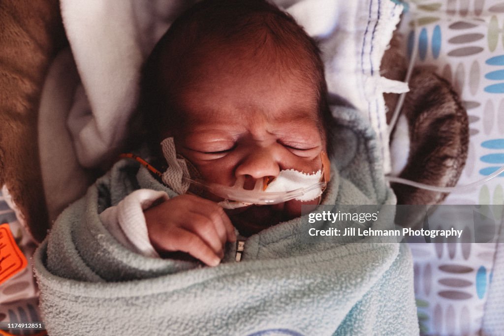 Premature Baby Sleeping in NICU with Oxygen and Feeding Tubes