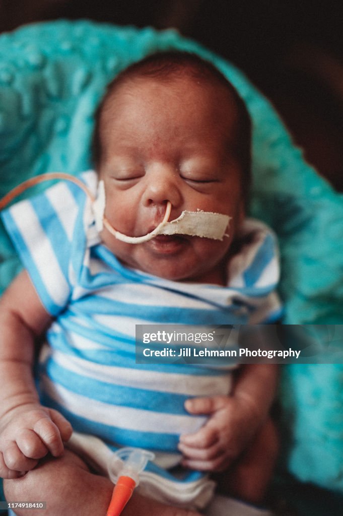 29 Week Premature Baby Is Fed By Tube on Mother in Hospital in the NICU