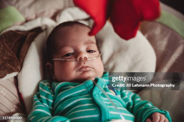 baby wearing nasal canula and oxygen relaxes at home in a chair - oxygen tube stock pictures, royalty-free photos & images