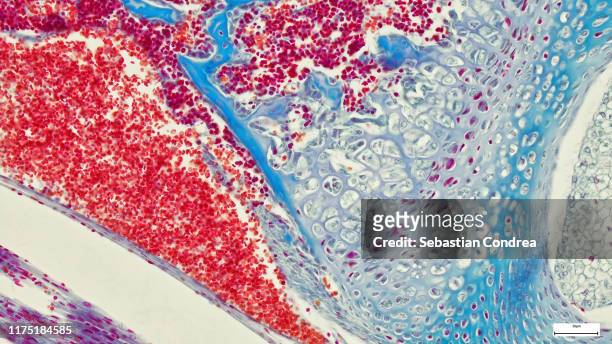 cartilaginous tissue, spongy bone blades and hematomas, animal, mouse. - animal body part stock pictures, royalty-free photos & images