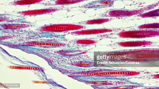 anatomy and histological sample simple columnar epithelium tissue under the microscope, organ, tegument with hairs,  coloration, knees, elbow, bone of mouse animal - tejido epitelial fotografías e imágenes de stock