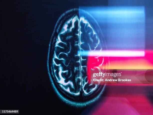 refection of mri brain scan on monitor display - scientific imaging technique stock pictures, royalty-free photos & images