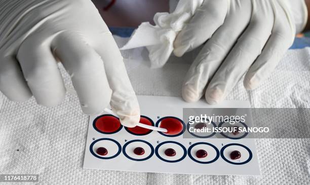 Technicians analyze blood drawn from people as they take part in an Human African Trypanosomiasis, also known as sleeping sickness, screening in the...