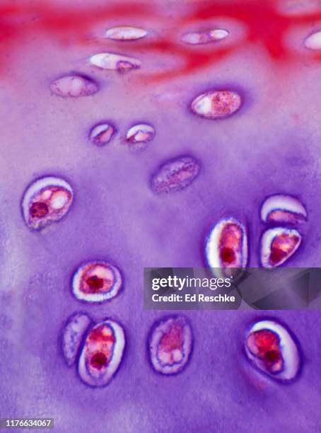 Hyaline Inclusions Hyaline Cartilage Connective Tissue Photos and Premium High Res ...